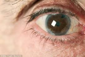 The name for a common eye disease where pressure increases in the intraocular space in one or both eyes. New Eye Test Could Detect Glaucoma Years Earlier Daily Mail Online
