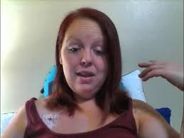 What to expect after pacemaker surgery day 1