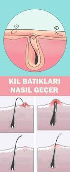 How To Pass Hair Worms Hautpflege Haare Gesunde Haare