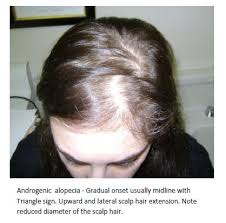 Dogs with illnesses besides thyroid disease or that are on certain drugs may have low. Pin On Hair And Beauty