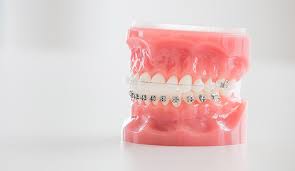 Life is like a mirror, we get the best results when we smile at it. unknown. Kieferorthopade Munchen Zahnspangen Kieferorthopadie Kfo Better Smile