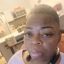 Missed dialysis treatment due to fatigue