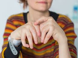 Rheumatoid arthritis (ra) is an autoimmune disease in which the body's immune systemclose immune system: Cancer Risk And Rheumatoid Arthritis