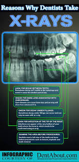 We did not find results for: The Reasons We Take X Rays Dentist In Streeterville Chicago