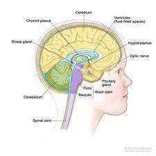 It has a high chance of recurrence as a higher grade tumor. Brain Tumors In Children Curesearch