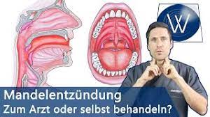 Als allgemeine richtlinie gilt, dass ein arzt aufgesucht werden sollte, sobald neben der rachenentzündung auch stärkere allgemeinsymptome, wie hohes fieber oder atemnot , auftreten oder sich ein bakterieller infekt zur rachenentzündung gesellt hat. Mandelentzundung Halsschmerzen Schnell Loswerden Was Sie Wissen Mussen Wenn Sie Betroffen Sind Youtube
