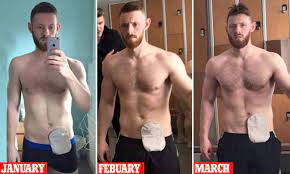 Man With Crohn S Disease Takes Gym Selfies Showing His Colostomy Bag Daily Mail Online