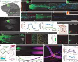One stop centre visa & macsmalaysia automated clearance system johor bahru •. An Ocular Glymphatic Clearance System Removes B Amyloid From The Rodent Eye Science Translational Medicine