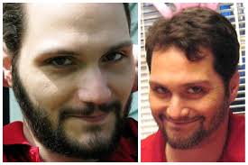 Reward Increased in Matthew Dion Fugitive Case