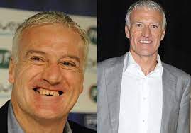 Дешам дидье / didier deschamps. Didier Deschamps Dit Pourquoi Il S Est Fait Refaire Les Dents Elle