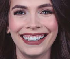 Fotografía facial con sonrisa espontánea del caso finalizado.