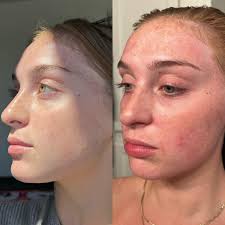 Reviews of Nikole Jayms Esthetics