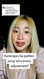 When to Change Wire Braces: A Guide