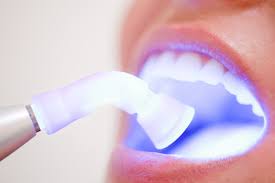 Whitening strips with invisalign … is that right? How To Whiten Your Teeth 17 Ways To Brighten Your Smile Allure