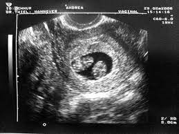 Pin On Baby Journey