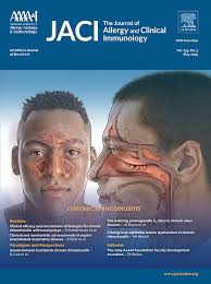 A dose-ranging study of the efficacy and safety of azelastine nasal spray  in the treatment of seasonal allergic rhinitis with an acute model