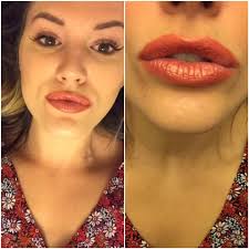 Well I'm totally disappointed in my Karndean so discolored