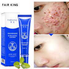Check spelling or type a new query. Buy Online Cleansing Acne Treatment Blackhead Remover Anti Acne Cream Oil Control Shrink Pores Acne Scar Remove Face Care Cream 30g Talm2 Alitools