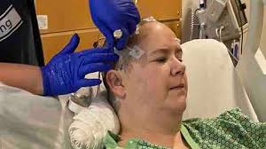 Fundraiser for Jay Kirgis by Olivia Whitehead : Rachel's Broken Brain