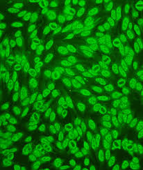 Image result for ANA Staining Pattern