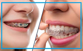 Wellington Orthodontics Orthodontist Gumucio Dental Invisalign Cosmetic Dentistry Orthodontic Treatment