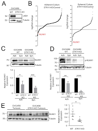 Delivering electrical services, solar pv, battery storage e.g. Cancers Free Full Text A Novel Role For Nuak1 In Promoting Ovarian Cancer Metastasis Through Regulation Of Fibronectin Production In Spheroids Html