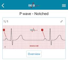 Image result for P Wave