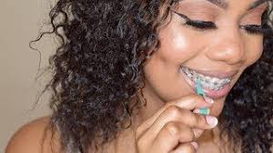 Apr 08, 2021 · put the rubber band around your teeth. How To Apply Elastics Rubber Bands To Braces Youtube