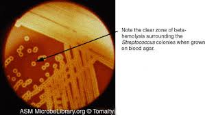 Image result for Group D Streptococcus