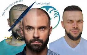 Ansi Agolli Champion of Azerbaijan for the fourth time