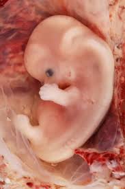 Genetistas De Melbourne Hacen Un Nuevo Descubrimiento Sobre Como Se Desarrolla El Sexo Del Bebe