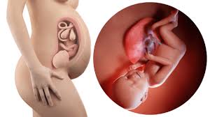 The time between dilating to 1 cm and giving birth varies from woman to woman. Week 38 Pregnancy 1 Cm Dilated Signs Of Labor Kopa Birth