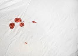 Secara umum, warna darah haid pada wanita adalah merah. Alasan Kenapa Darah Haid Menggumpal Ternyata Sudah Tertera Dalam Al Qur An