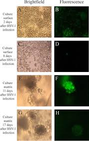 It can also be spread through contact with lesions from other areas of the body. Morphology Of Cultures A C E G And Hsv 1 Infection Mediated Gfp Download Scientific Diagram