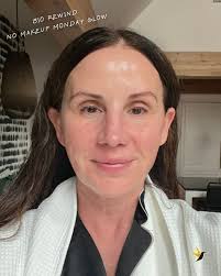 That #NoMakeupMonday glow thanks to @skinbetter's BioRewind 💊☀️ Skincare  doesn't have to be complicated — that's where we come in. We're here to  guide you toward healthy, glowing skin with science-backed solutions