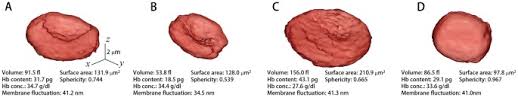 We did not find results for: Profiling Individual Human Red Blood Cells Using Common Path Diffraction Optical Tomography Scientific Reports
