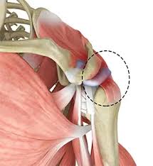 Image result for Rotator Cuff Injury