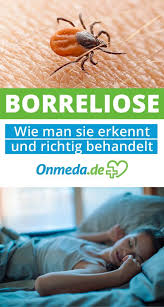 Borreliose Symptome Ursachen Behandlung Onmeda De Zeckenbiss Schluckbeschwerden Zeckenbiss Borreliose