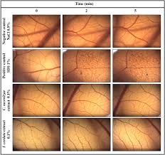 Image result for Rogiera cordata