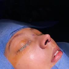 Dr. Carlos Rivas Tremont Otorrino(@carlosrivast) • Instagram 사진 및 동영상