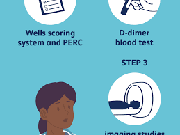 How to test for pulmonary embolism. How Pulmonary Embolism Is Diagnosed