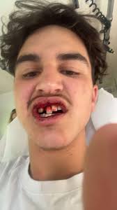 🔴 Rugby : la troisième mi-temps des cadets tourne à la bagarre générale  dans le Sud-Ouest, des plaintes bientôt déposées 🔗https://l.sudouest.fr/tIT