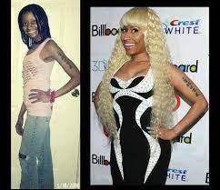 These hottest nicki minaj photos will make you wonder how someone so beautiful could exist. What Everybody Ought To Know About Nicki Minaj Plastic Surgery Read More Https Plentat Com Nicki Minaj Nicki Minaj Plastic Surgery Celebrity Plastic Surgery