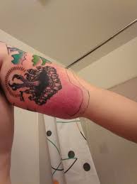 What to expect during laser tattoo removal? Tribal Tattoos X Tattoo Infection