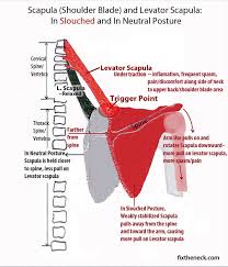 Pin On Trigger Point