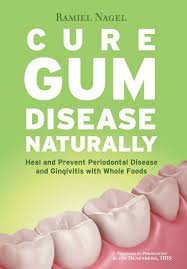 Cure Gum Disease Naturally Heal Gingivitis And Periodontal Disease With Whole Foods Amazon Com Br