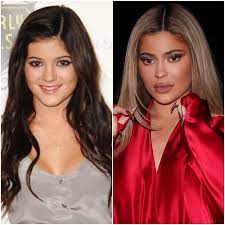 The stigma surrounding plastic surgery is disappearing as more mothers share their experiences, and why surg. Did Kylie Jenner Get Plastic Surgery See Transformation