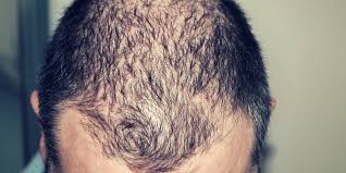 How to fix a bad haircut is one of the skills that modern stylists learn. Bad Haircut Don T Panic Here S What You Need To Do