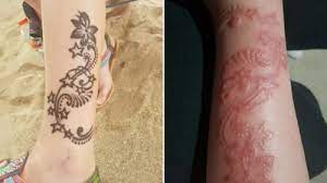 The scar remains almost two months after the henna was applied. Where To Get A Tattoo Without Needles Pain And An Infection