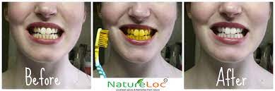 Turmeric Find Out How I Whitened My Teeth Without Going To The Doctor